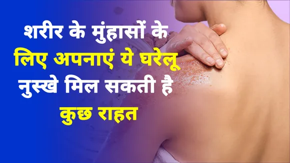 Natural tips for body acne, apply free cost products