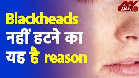 Beauty Tips Useful remedies for blackheads get rid of them today