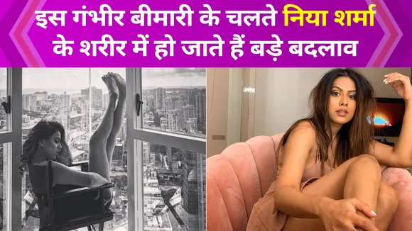 Nia Sharma has these problems related to the body, Watch Video