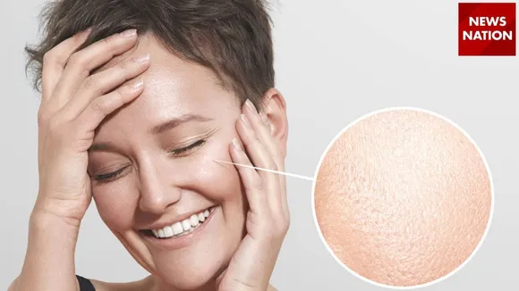 Open Pores