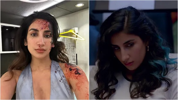 parul gulati injured