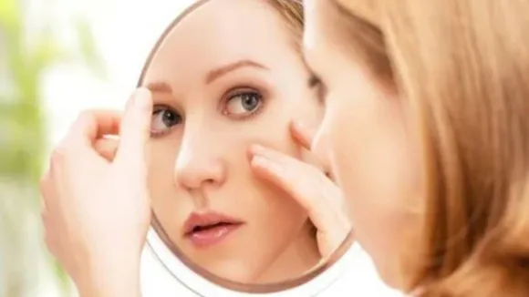 How To Fade Dark Spots Naturally