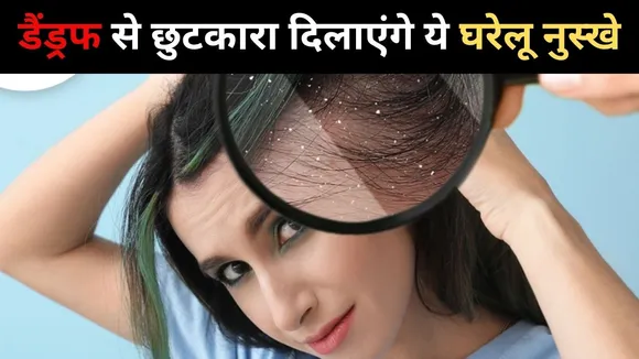 डैंड्रफ
