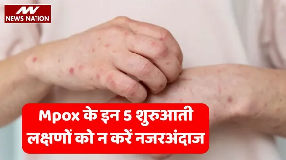 Mpox Early Symptoms