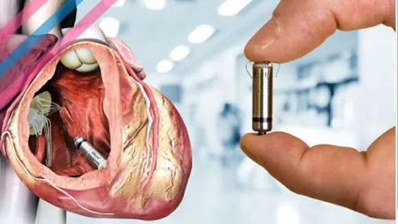 leadless pacemaker