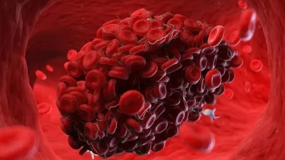 Blood Clots During Periods