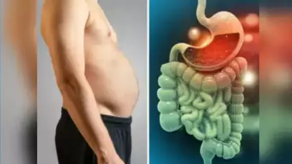 stomach bloating 1