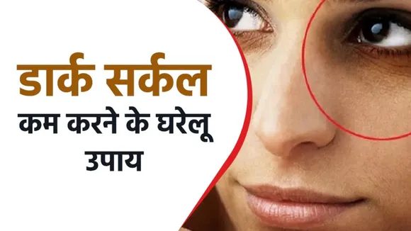 How to remove dark circles quickly