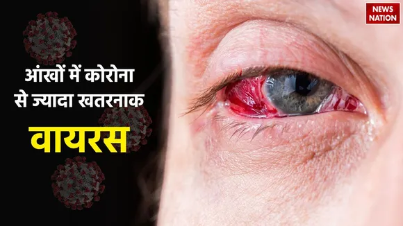 Eye disease