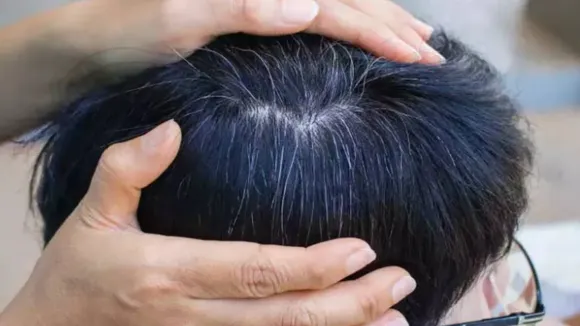 White Hair Solution