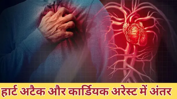 Heart Attack Vs Cardiac Arrest