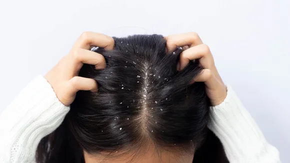 Best Anti Dandruff Shampoo