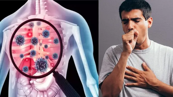 Chest Congestion Remedy
