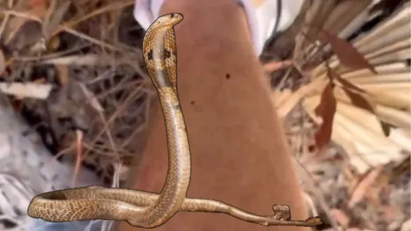 viral snake biten