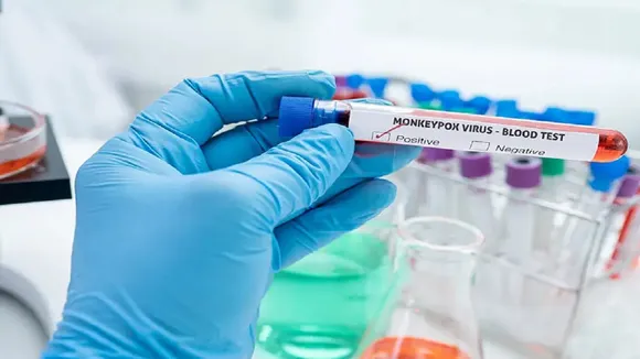 Monkeypox Virus New Strain