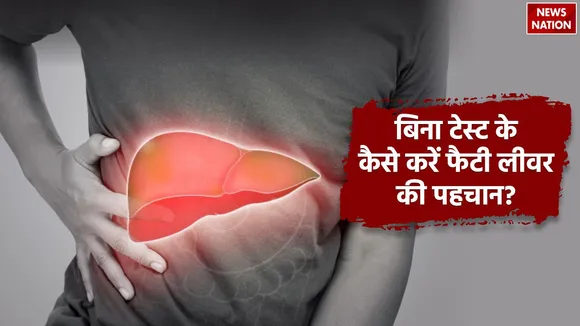 Fatty Liver