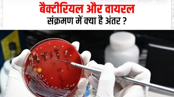 Viral Fever Or Bacterial Infection