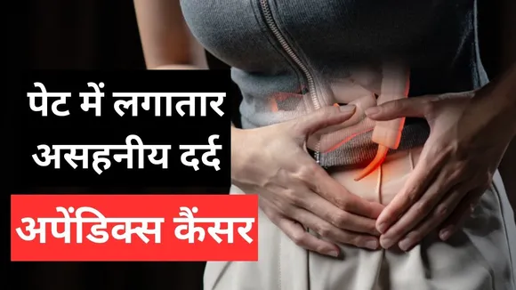 Appendix cancer