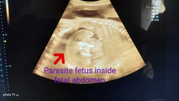 doctors were stunned to see the sonography of a pregnant woman