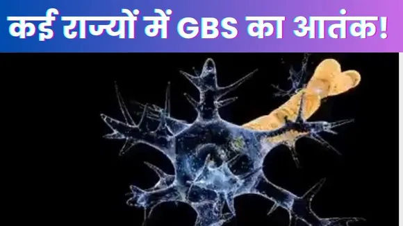 Deaths GBS Cases