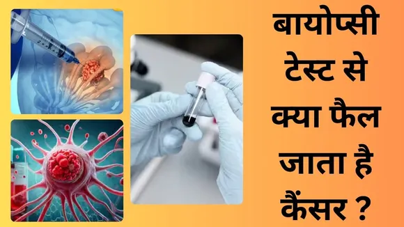 Biopsy Test for Cancer