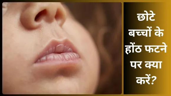Natural remedies for baby dry lips (1)