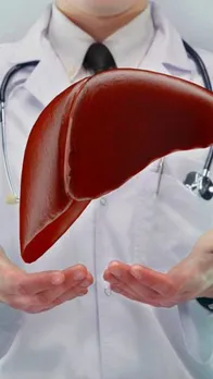 fatty liver 3