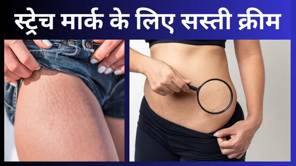 Stretch Mark Creams