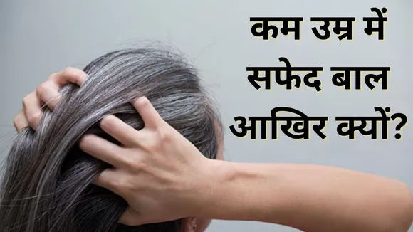 White Hair Remedies