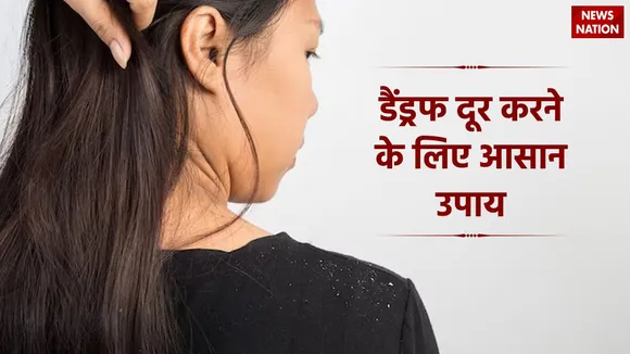 Dandruff Home Remedies