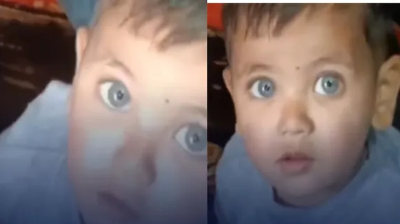 kid viral eyes news