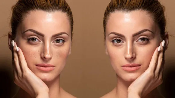 Skincare Routine For Hyperpigmentation