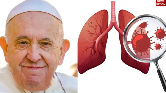 Pope Francis Death Reason