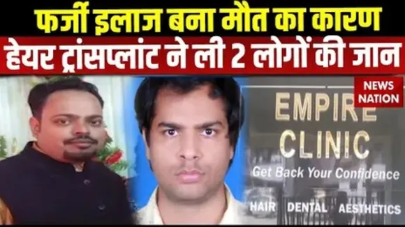 Kanpur hair transplant killed men