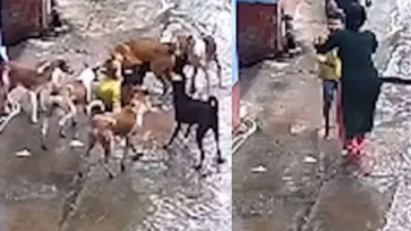 dogs attack on kids