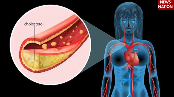 Cholesterol