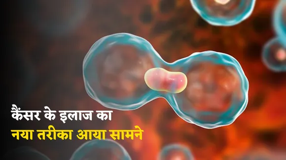 New Technique for Cancer treatment
