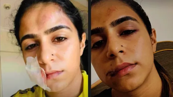 this actress made serious allegations of on her ex boyfriend said He kicked me in the stomach
