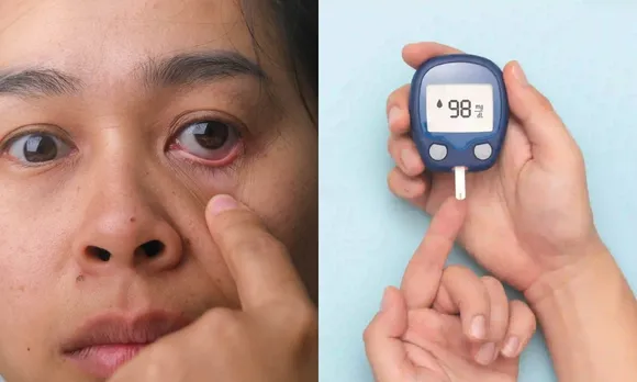 Diabetes Symptoms