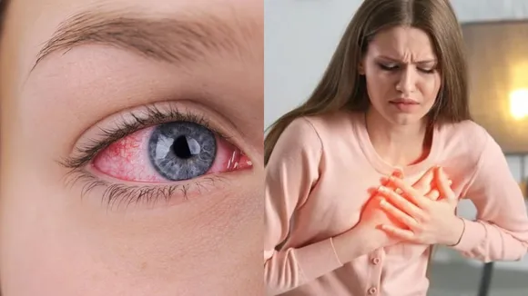 Heart Disease in Eyes