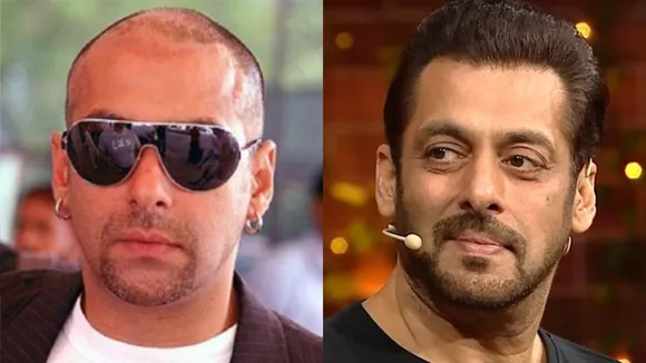 Salman Khan has undergone 5 6 hair transplants dr gaurang krishna revealed ranbir shahrukh