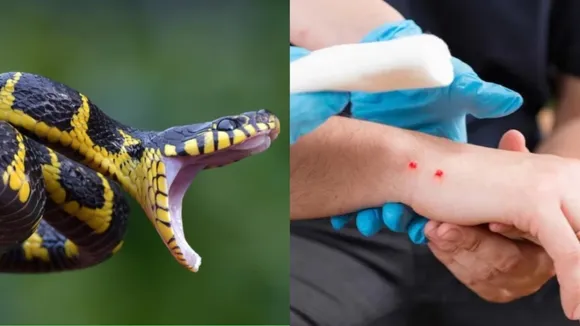 Snake Bite Treatment