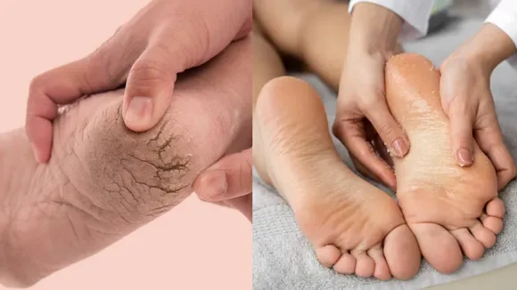 Winter Carcked Heels