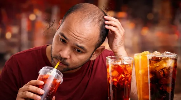Sweet Drinks And Hair Loss