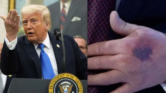 Donald Trump Blue Hand