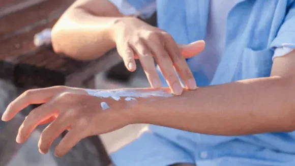 Tanning Removal Remedies