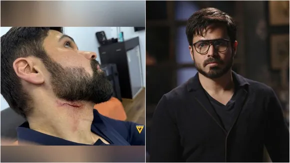 Emraan hashmi got injured
