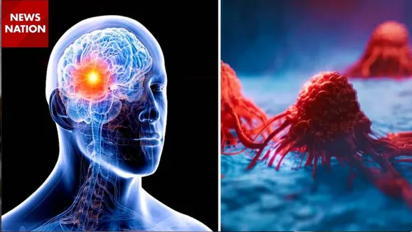 brain tumor