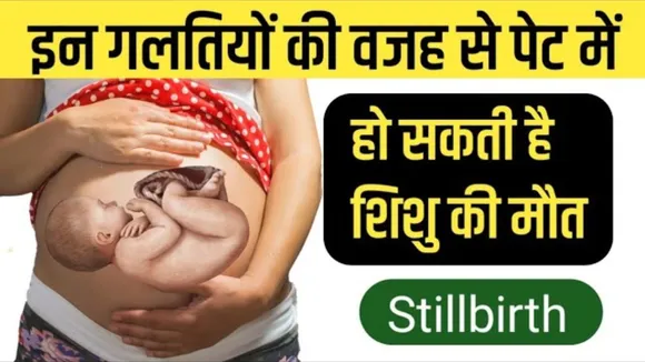 Stillbirth