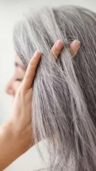 White hair problem 3